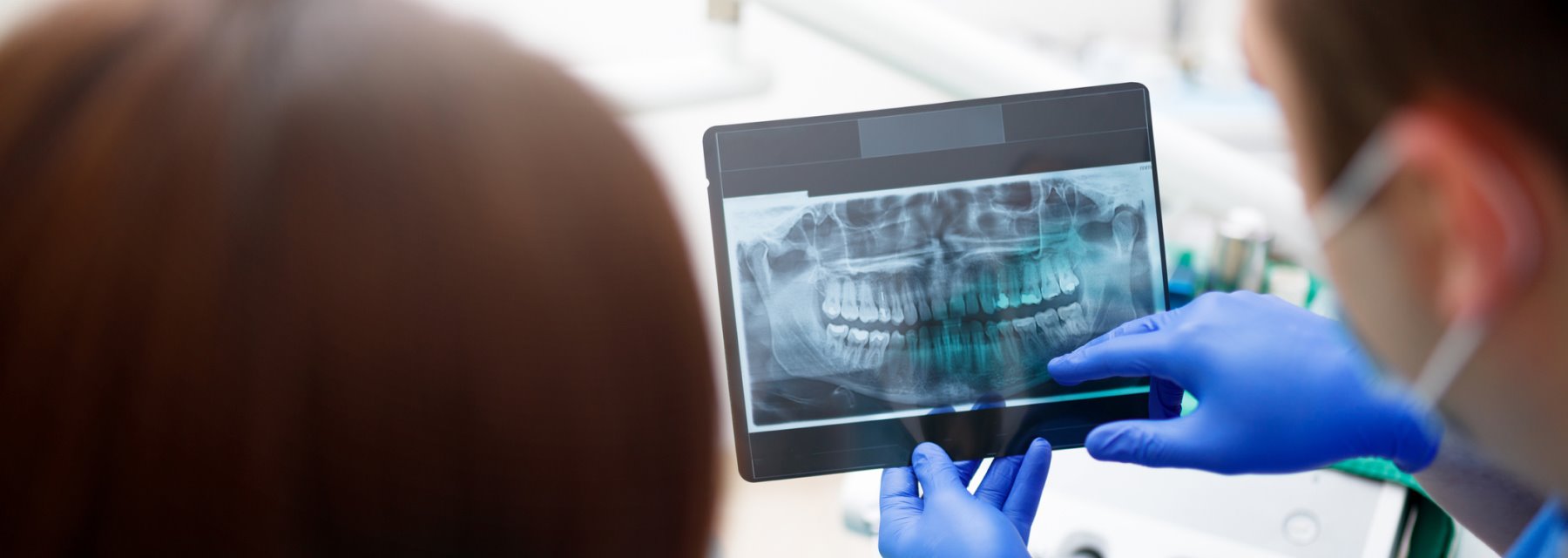 Digital X-rays for precise dental imaging